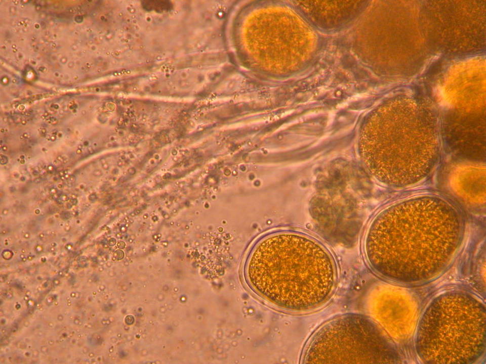 Endogone pisiformis image