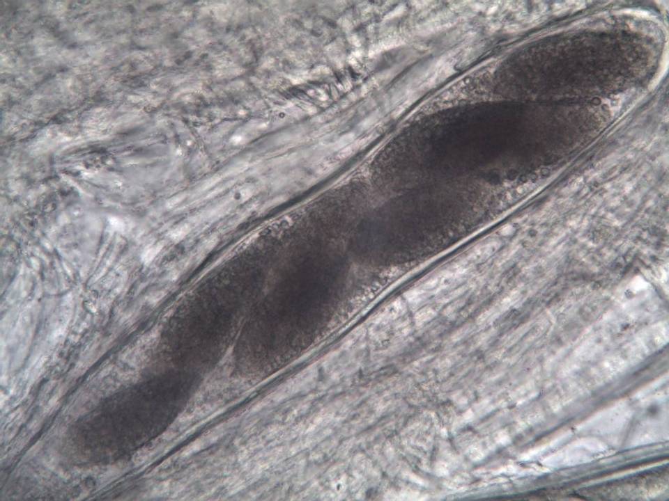 Pertusaria hymenea image