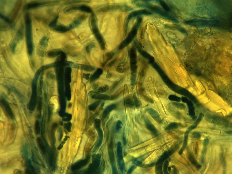 Cupreoboletus poikilochromus image