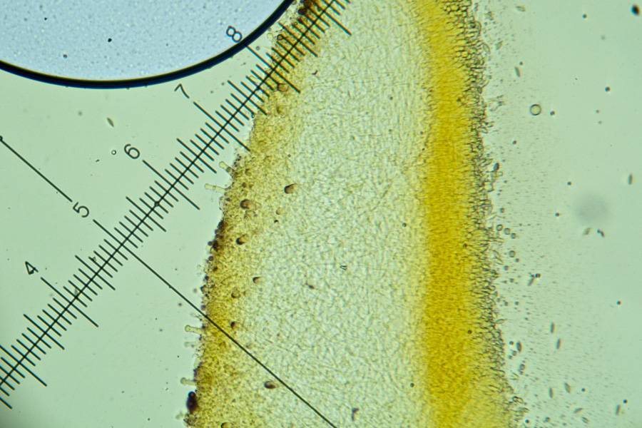 Gloiocephala menieri image