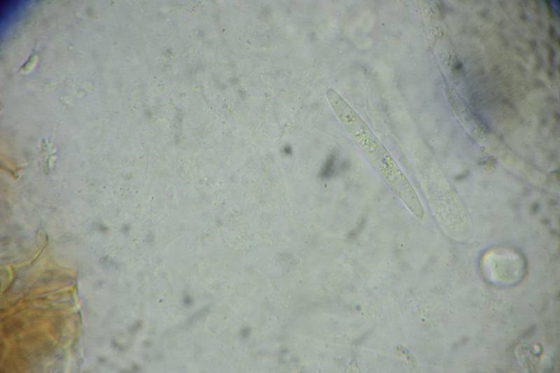 Calonectria pyrochroa image