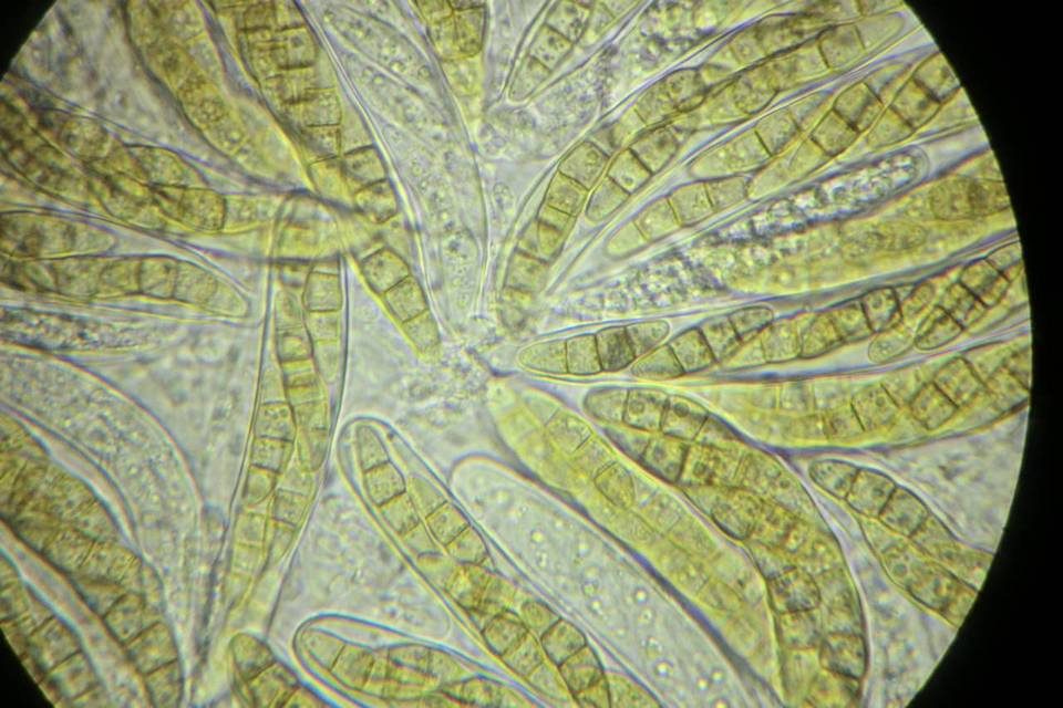 Phaeosphaeria culmorum image