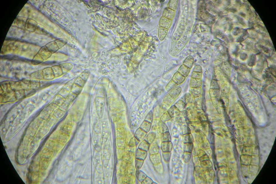 Phaeosphaeria culmorum image