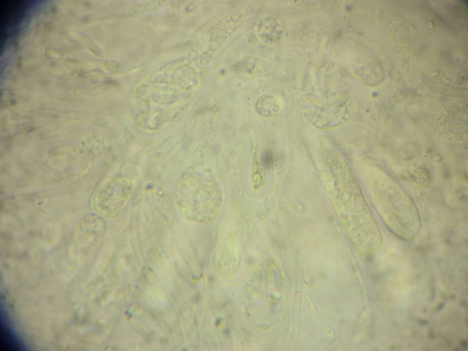 Calosphaeria cryptospora image