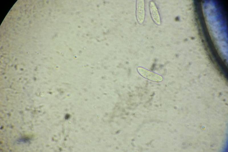 Cryptodiaporthe salicina image