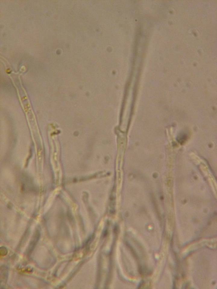 Dacrymyces variisporus image