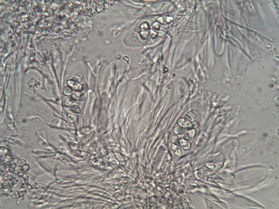 Caloplaca teicholyta image