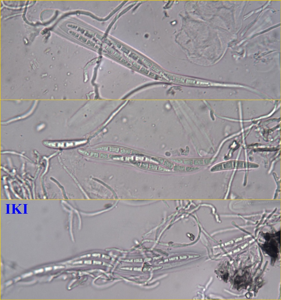 Schismatomma graphidioides image