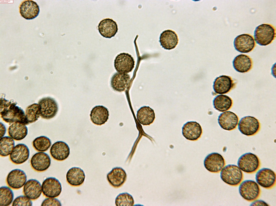 Reticularia jurana image