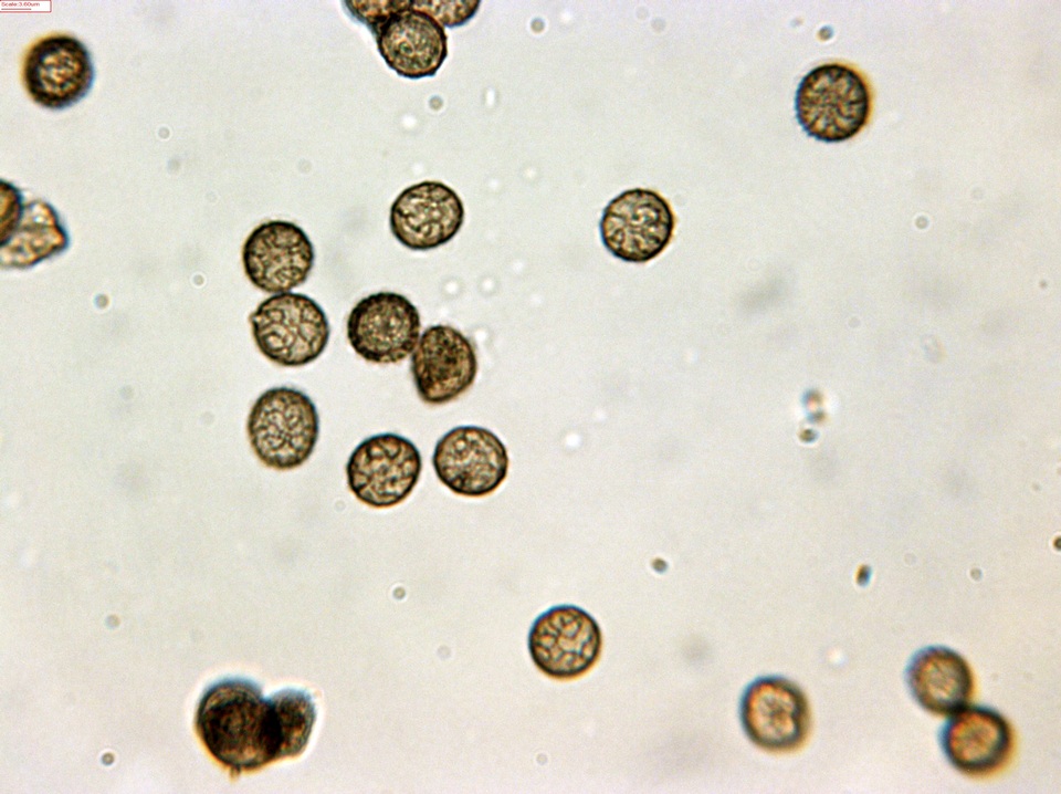 Reticularia jurana image