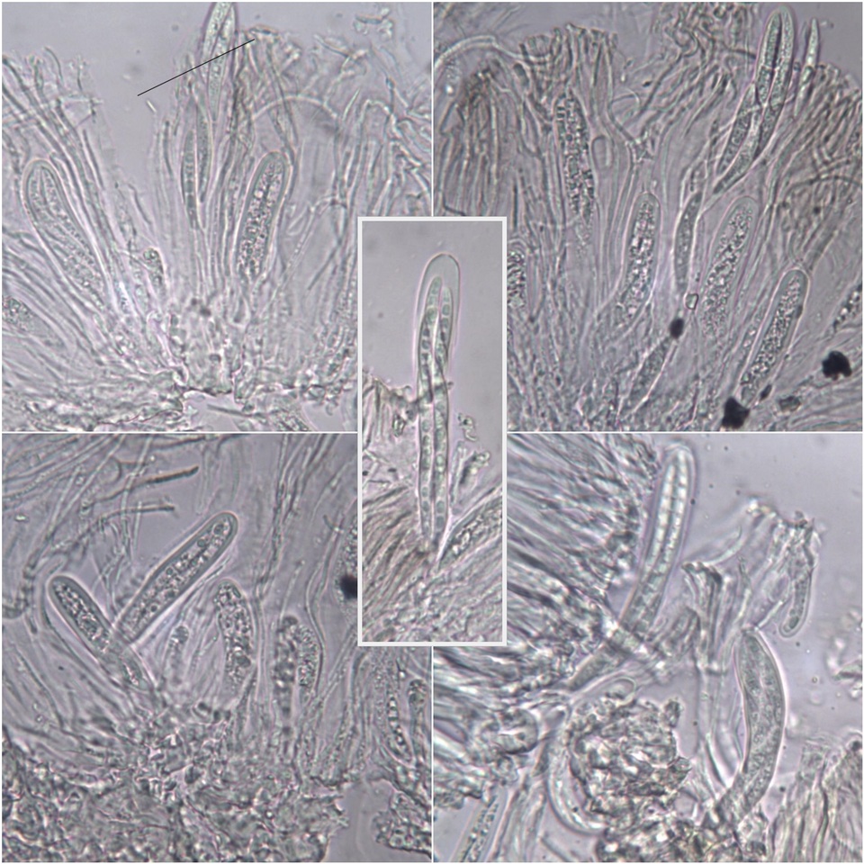 Enterographa hutchinsiae image