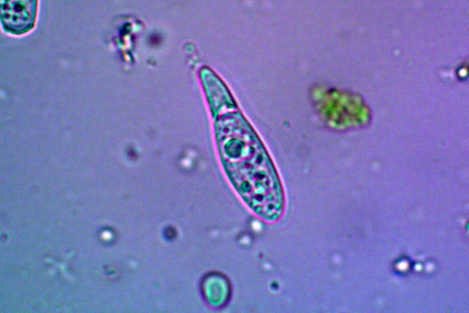 Cercidospora caudata image
