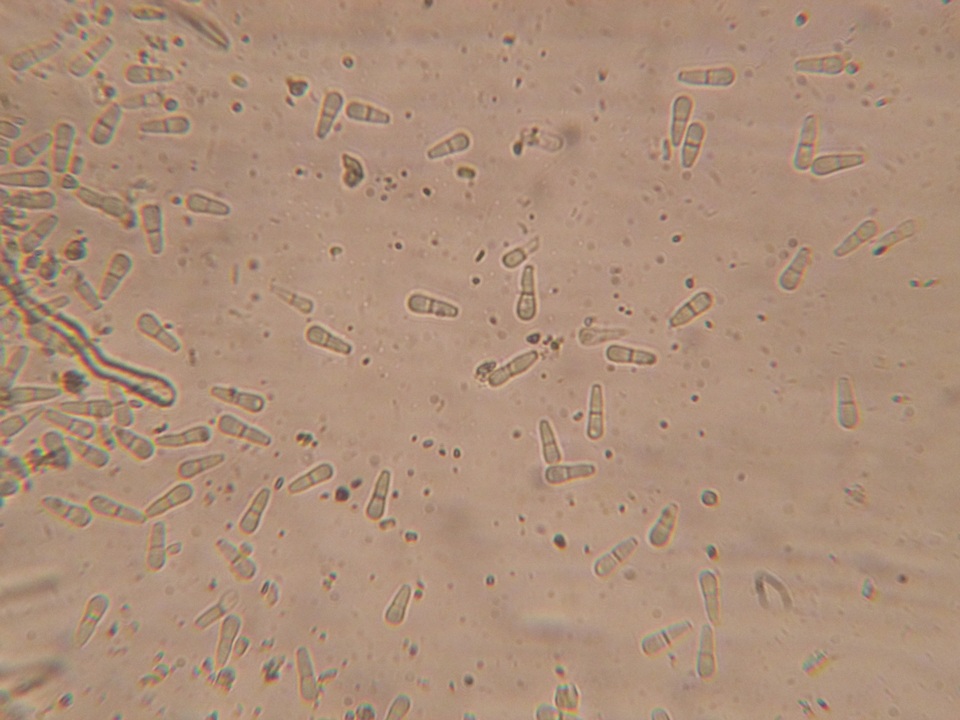 Neottiella albocincta image