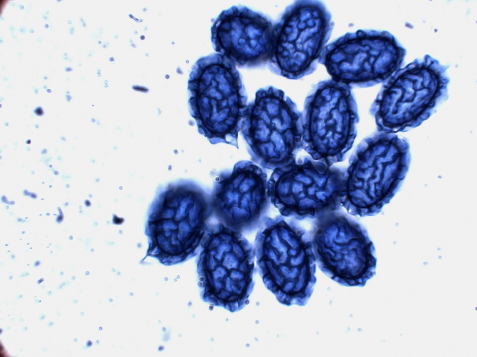 Scutellinia pseudotrechispora image