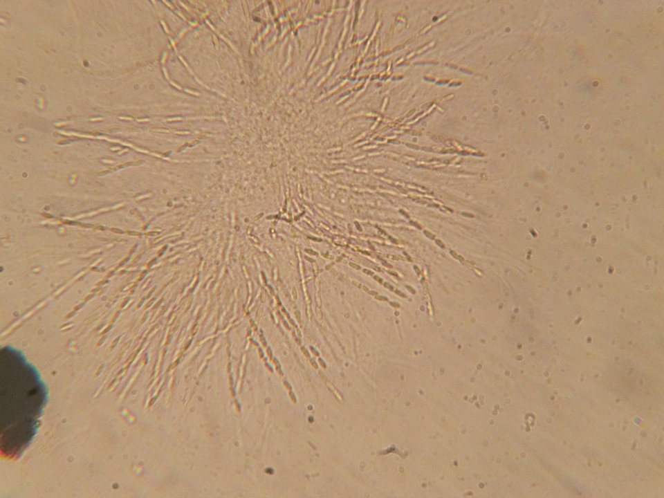 Chaetosphaeria myriocarpa image