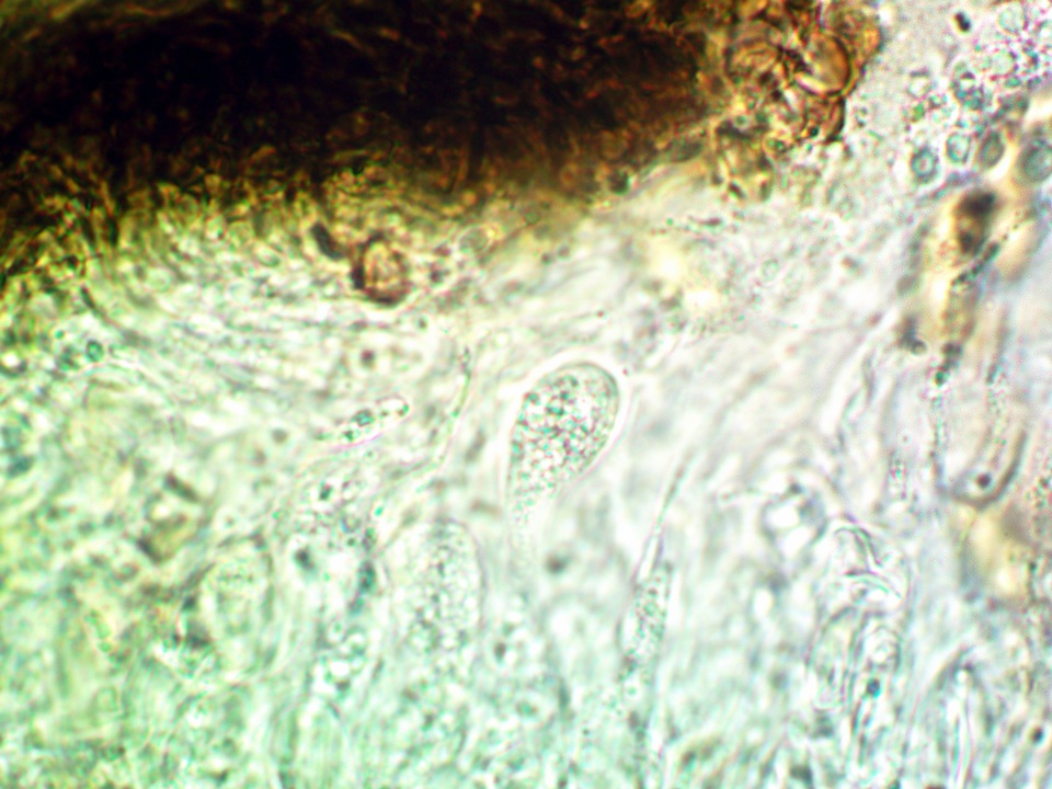 Lichenostigma image