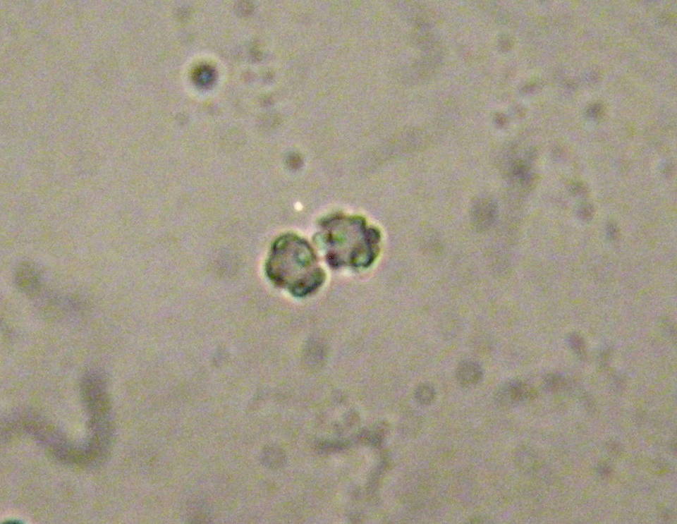 Hydnellum cyanopodium image