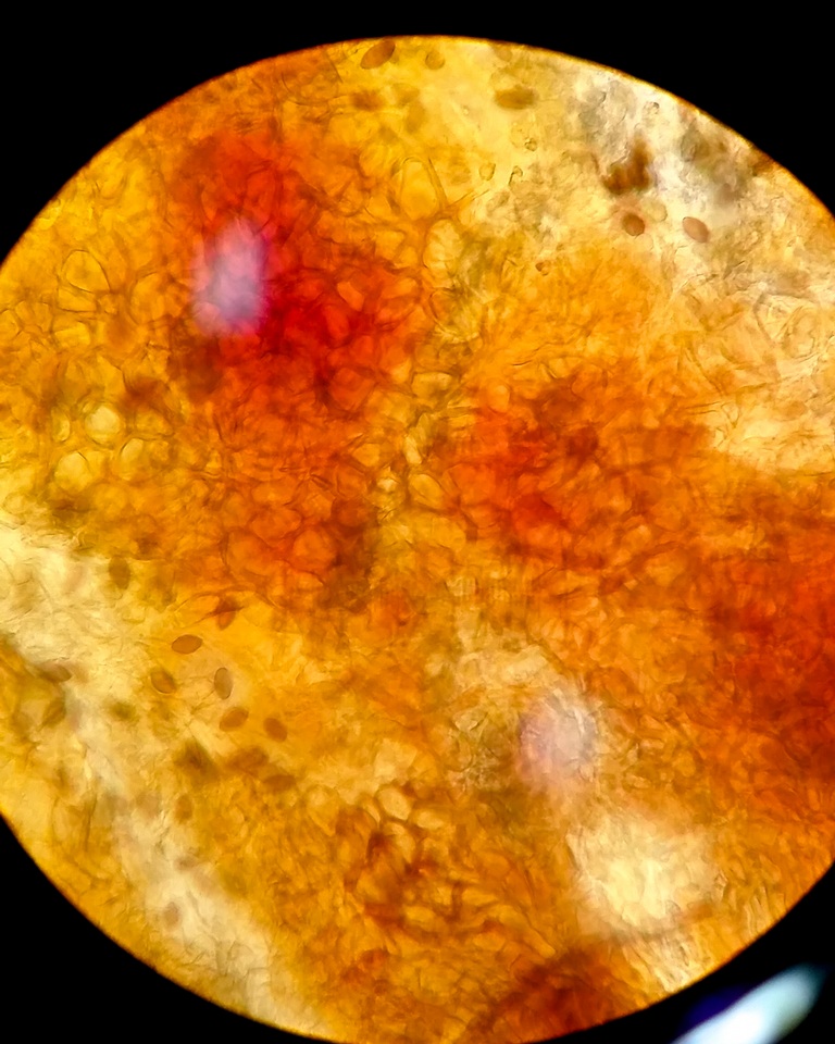 Melanospora lagenaria image