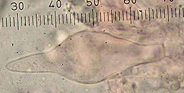 Mycenella trachyspora image