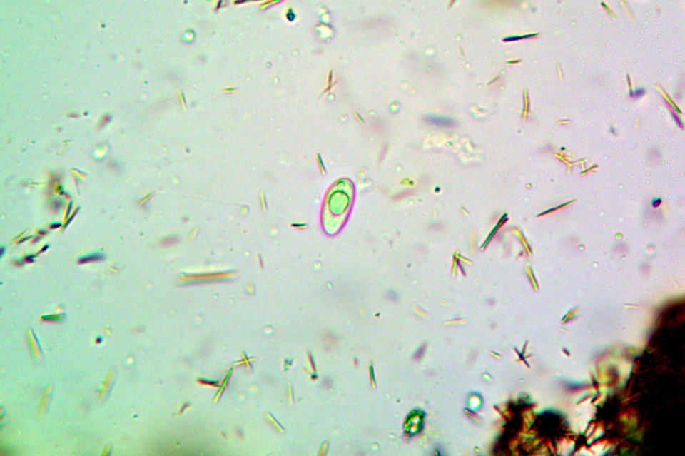 Lobothallia praeradiosa image