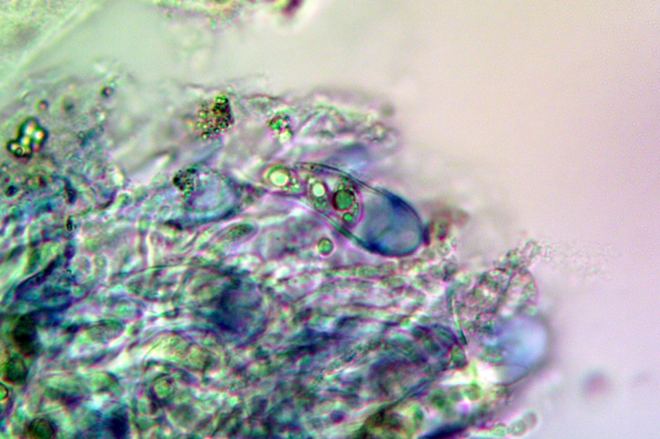 Lobothallia praeradiosa image