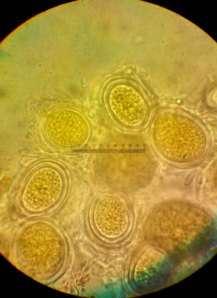 Endogone incrassata image