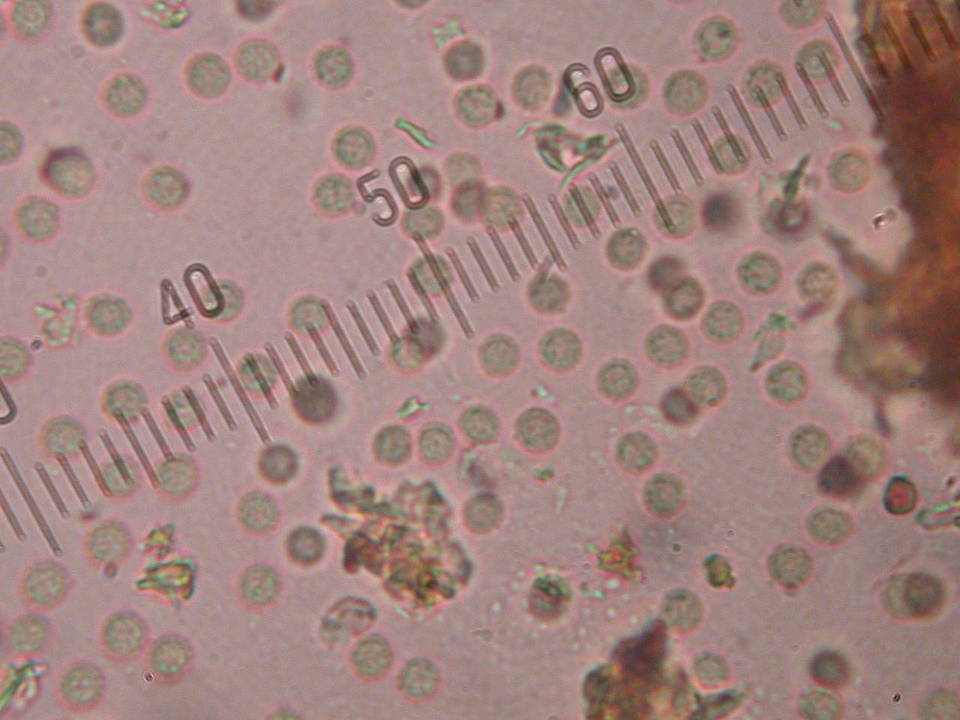 Reticularia lycoperdon image