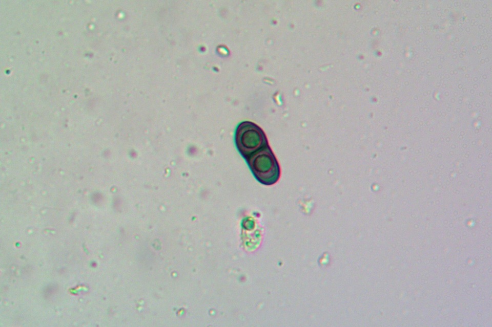 Rinodina innata image