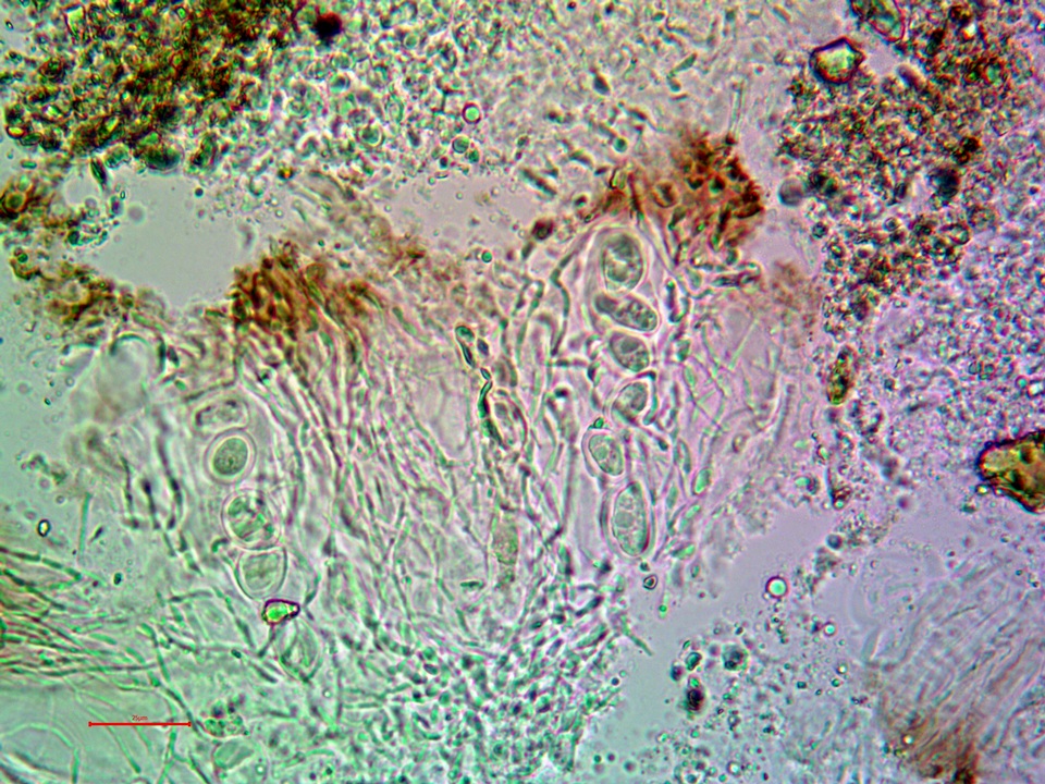 Aspicilia phaea image