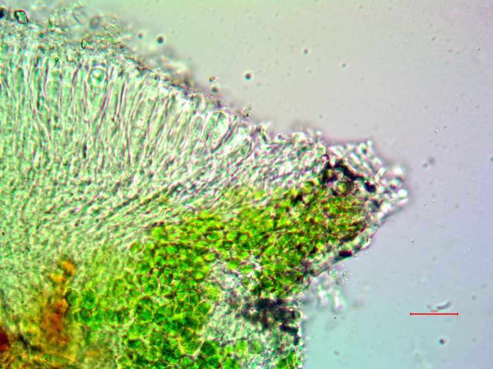 Lecanora substrobilina image