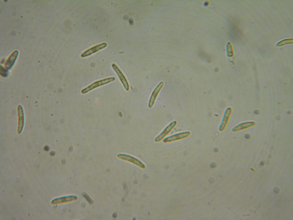 Mollisia ventosa image