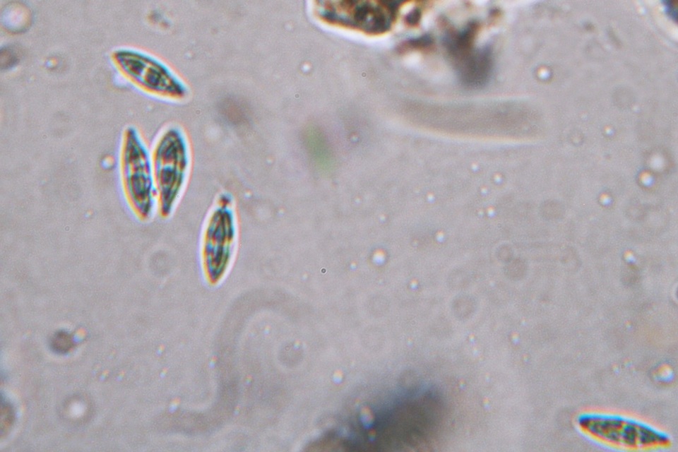 Phacopsis oxyspora image