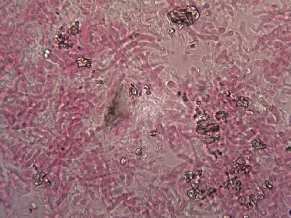 Marchandiomyces corallinus image