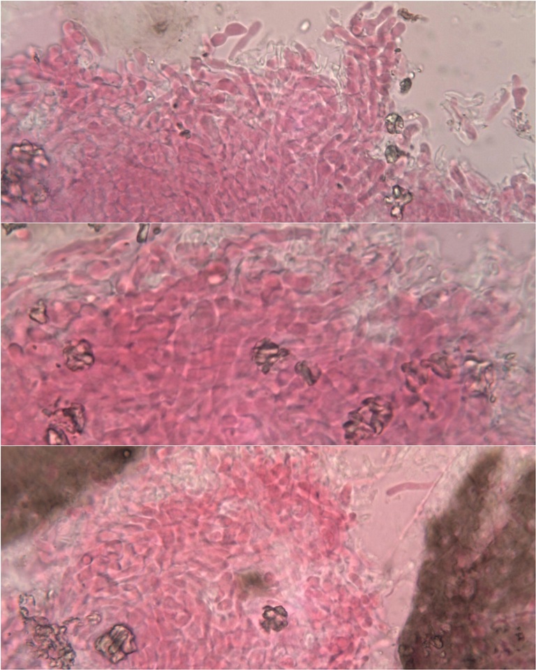 Marchandiomyces corallinus image