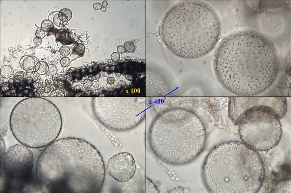Coprinopsis tuberosa image