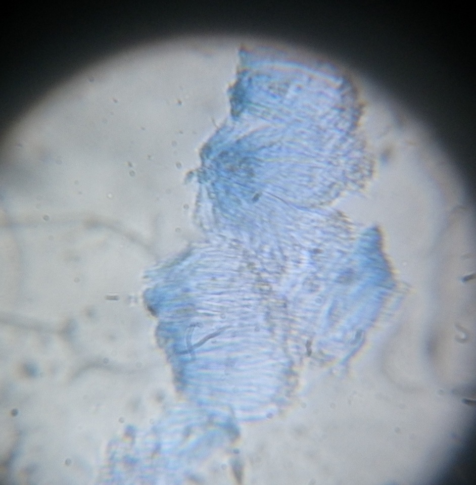 Cryptodiscus rhopaloides image