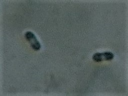 Natantiella ligneola image