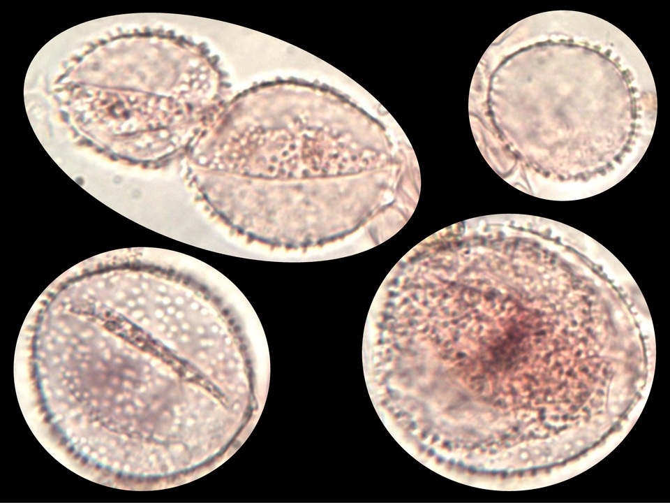 Coprinopsis foetidella image
