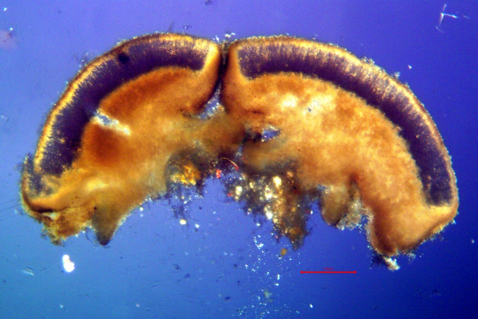 Trapeliopsis glaucopholis image