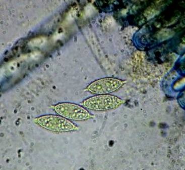 Peziza apiculata image