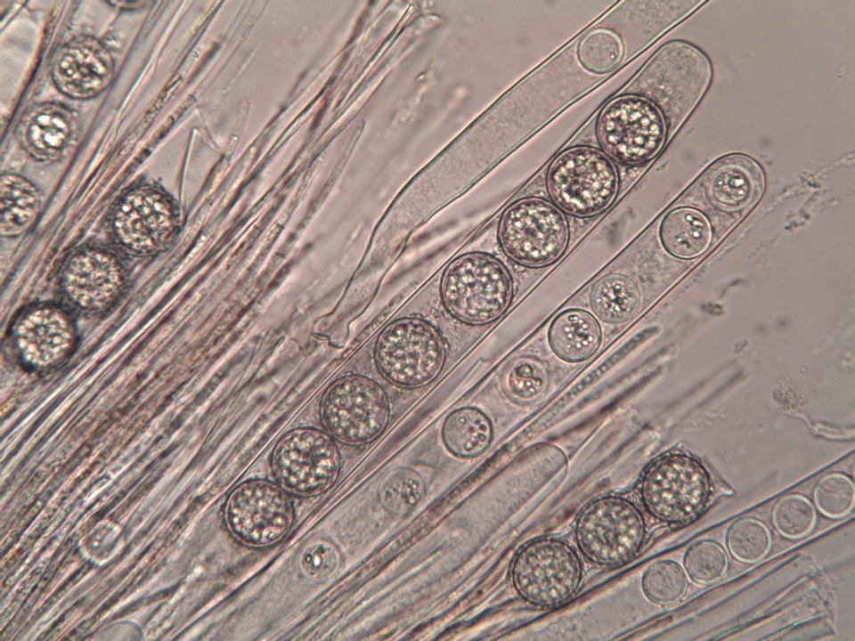 Scutellinia barlae image