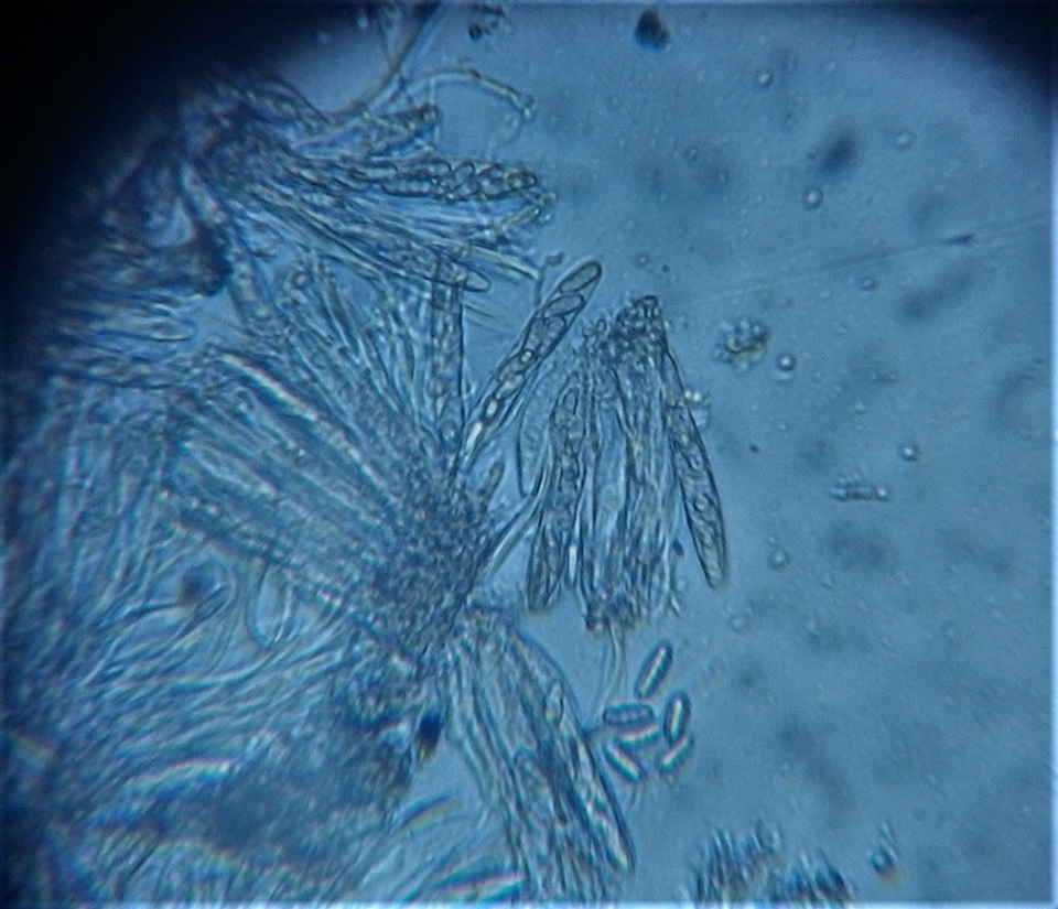 Petractis nodispora image