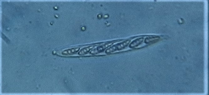 Petractis nodispora image