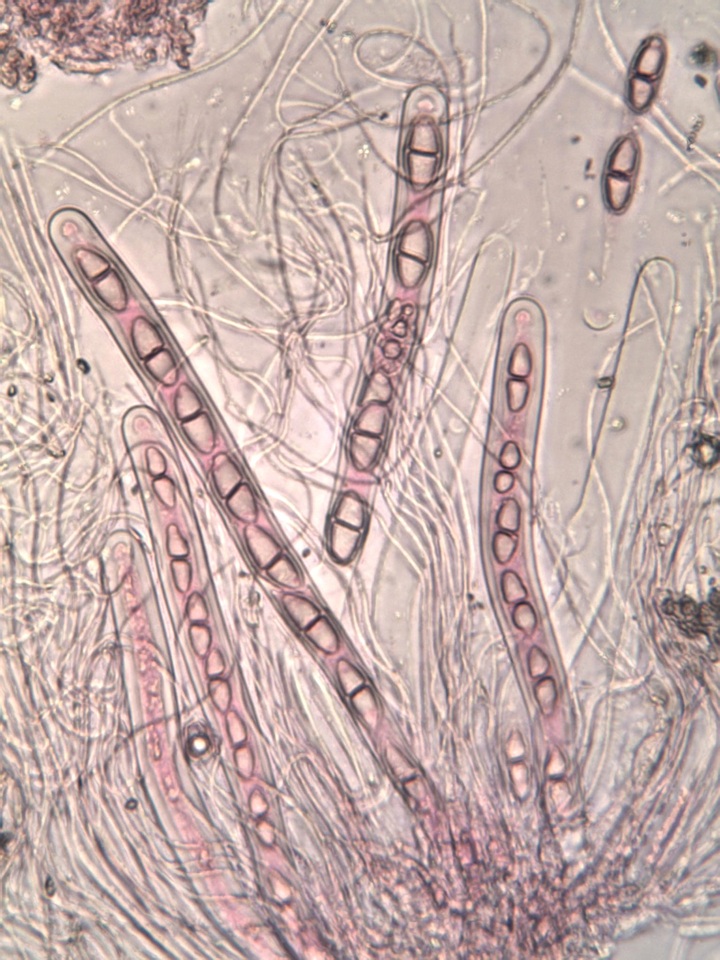 Acrocordia macrospora image