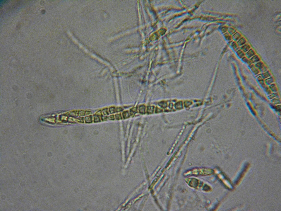 Erikssonopsis ericae image