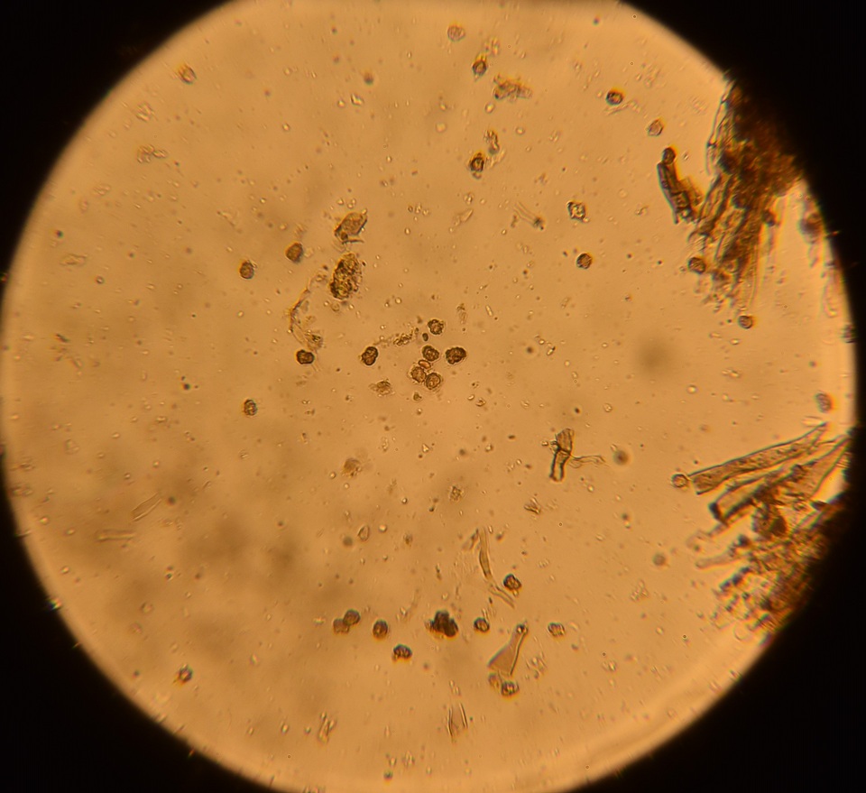Tomentella cinereoumbrina image