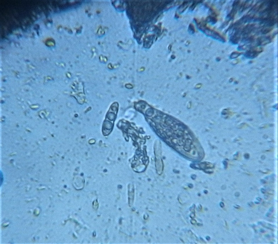 Mycoporum antecellens image