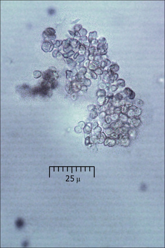 Cosmospora coccinea image