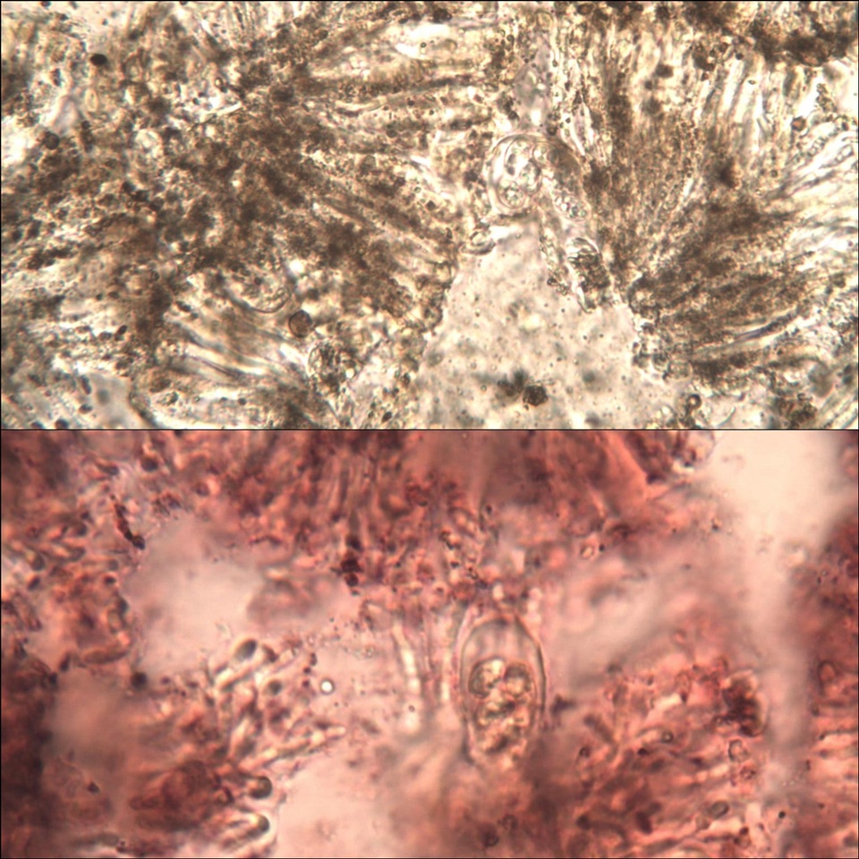 Protoblastenia calva image
