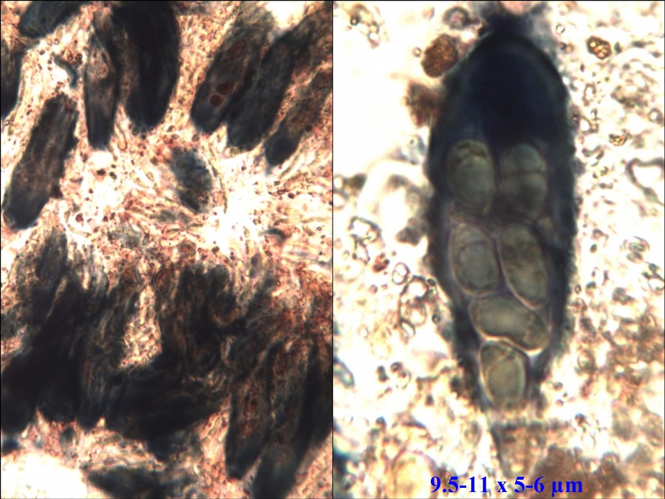 Protoblastenia calva image